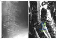 Orthopedic Prometric Exam Chapter 3 Image