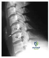 Orthopedic Prometric Exam Chapter 3 Image