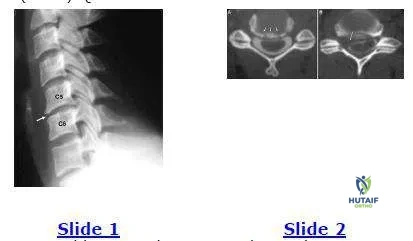 Orthopedic Prometric Exam Chapter 3 Image