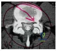 Orthopedic Prometric Exam Chapter 3 Image
