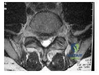 Orthopedic Prometric MCQs - Chapter 3 Part 28
