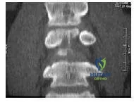 Orthopedic Prometric Exam Chapter 3 Image