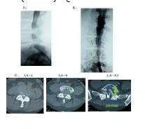 Orthopedic Prometric Exam Chapter 3 Image
