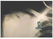 Orthopedic Prometric Exam Chapter 3 Image