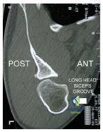 Orthopedic Prometric MCQs - Chapter 3 Part 40
