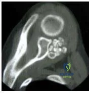 Orthopedic Prometric Exam Chapter 3 Image