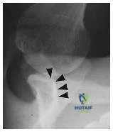 Orthopedic Prometric Exam Chapter 3 Image