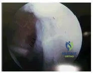 Orthopedic Prometric Exam Chapter 3 Image