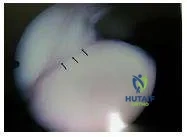 Orthopedic Prometric MCQs - Chapter 3 Part 43