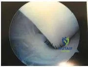 Orthopedic Prometric Exam Chapter 3 Image