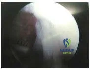 Orthopedic Prometric Exam Chapter 3 Image