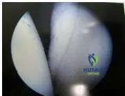 Orthopedic Prometric Exam Chapter 3 Image