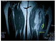 Orthopedic Prometric Exam Chapter 3 Image