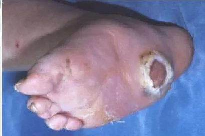 Orthopedic Prometric Exam Question