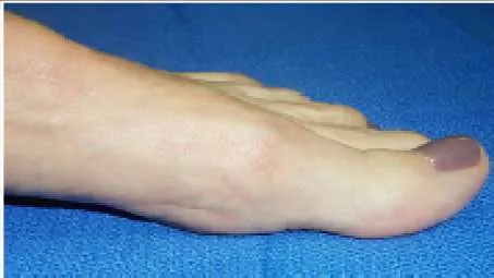 Orthopedic Prometric Exam Question