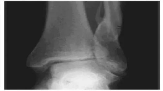 Orthopedic Prometric Exam Question