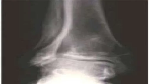 Orthopedic Prometric Exam Question