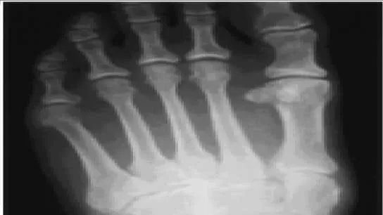 Orthopedic Prometric Exam Question