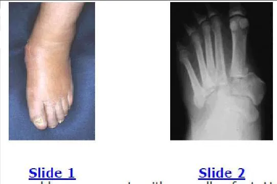 Orthopedic Prometric Exam Question