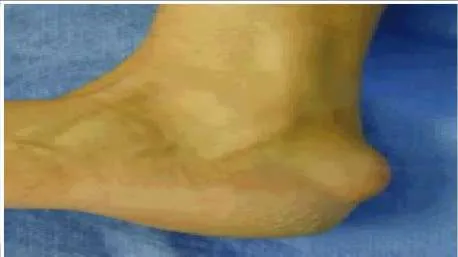 Orthopedic Prometric Exam Question