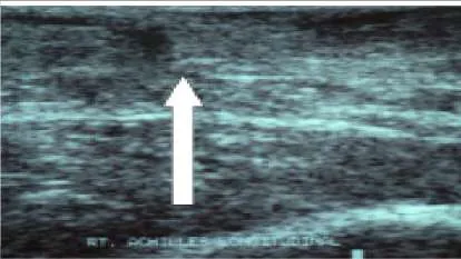 Orthopedic Prometric Exam Question