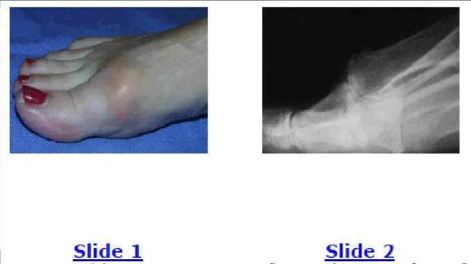 Orthopedic Prometric Exam Preparation MCQs - Part 3