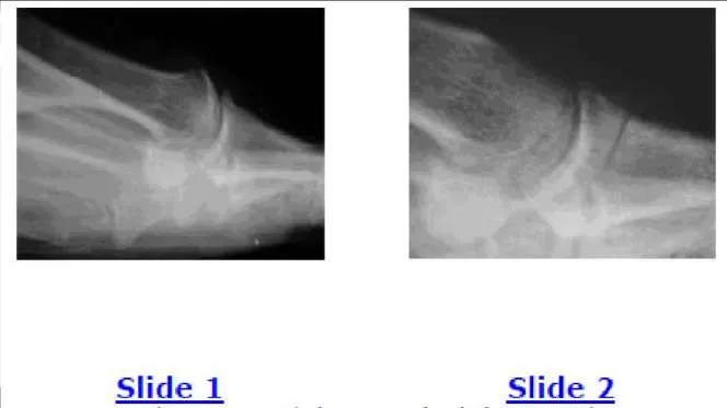 Orthopedic Prometric Exam Question