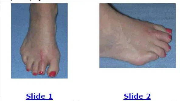 Orthopedic Prometric Exam Question