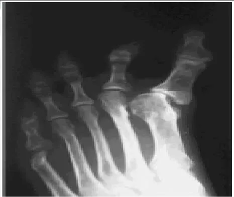 Orthopedic Prometric Exam Question