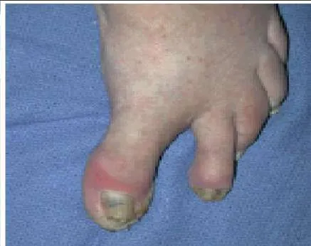 Orthopedic Prometric Exam Question