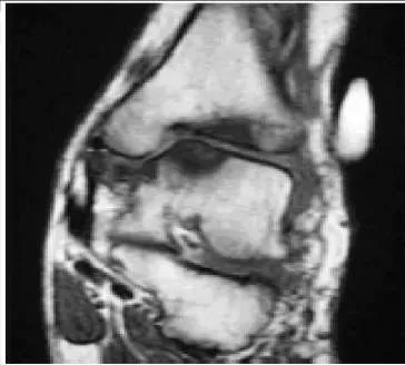 Orthopedic Prometric Exam Question