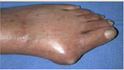 Orthopedic Prometric Exam Preparation MCQs - Part 4