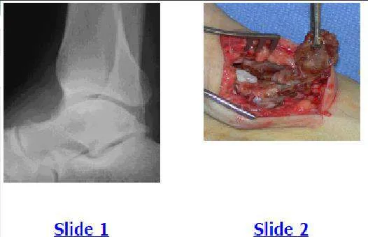 Orthopedic Prometric Exam Question