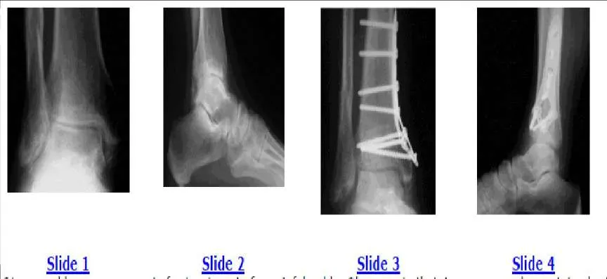 Orthopedic Prometric Exam Question