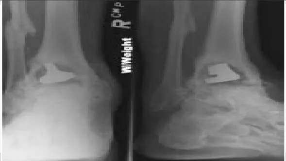 Orthopedic Prometric Exam Question