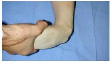 Orthopedic Prometric Exam Question