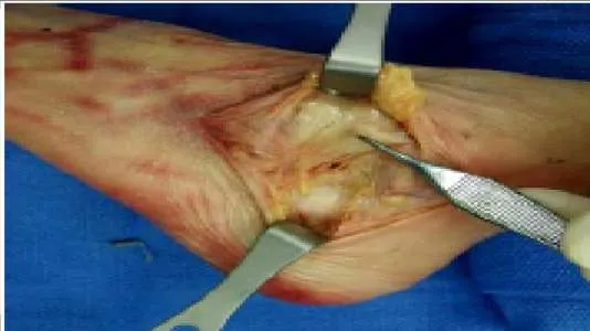 Orthopedic Prometric Exam Question