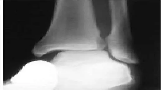 Orthopedic Prometric Exam Question