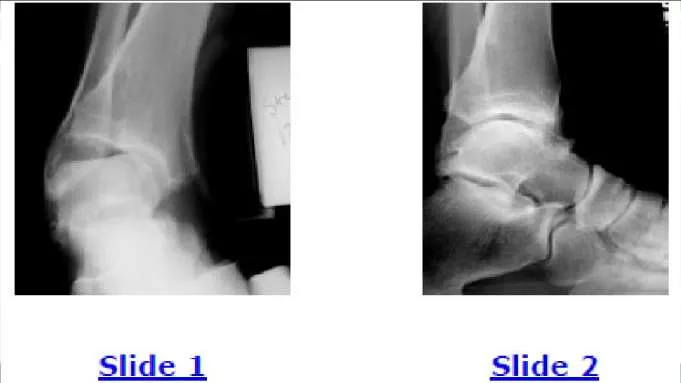 Orthopedic Prometric Exam Question