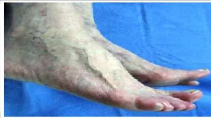 Orthopedic Prometric Exam Question