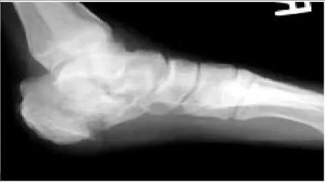 Orthopedic Prometric Exam Question