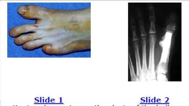 Orthopedic Prometric Exam Question