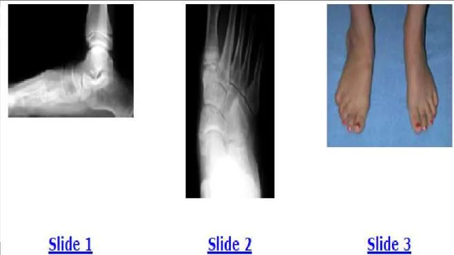 Orthopedic Prometric Exam Question