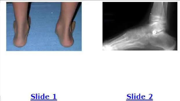 Orthopedic Prometric Exam Question