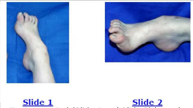 Orthopedic Prometric Exam Question