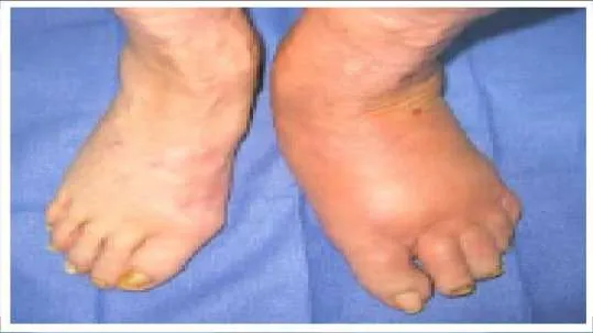 Orthopedic Prometric Exam Question