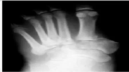 Orthopedic Prometric Exam Question