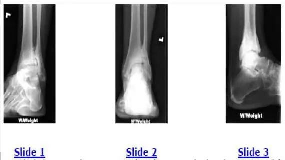 Orthopedic Prometric Exam Question