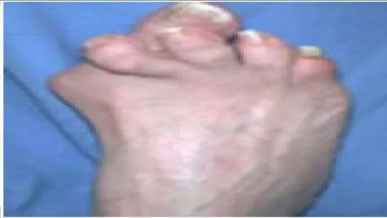 Orthopedic Prometric Exam Question