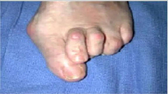 Orthopedic Prometric Exam Question